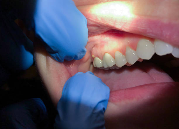 Best Emergency Gum Pain Relief  in Pion Hills, CA